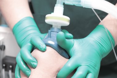 Solunum maskesi aracılığıyla. inhalasyon anestezi