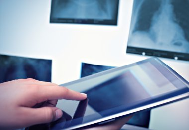 Radyoloji dijital tablet ile çalışma