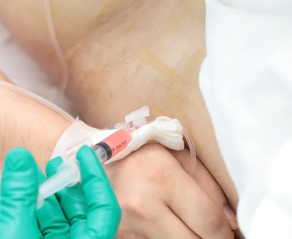 Injectie in de katheter uit de patiënt. — Stockfoto