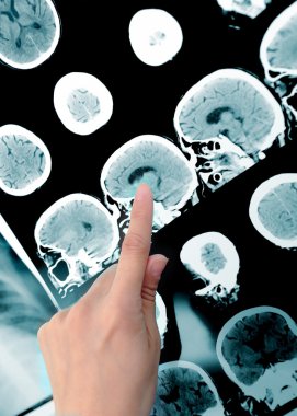 görüntüleme alanını işaretleyin. Doktor ve ct taraması.