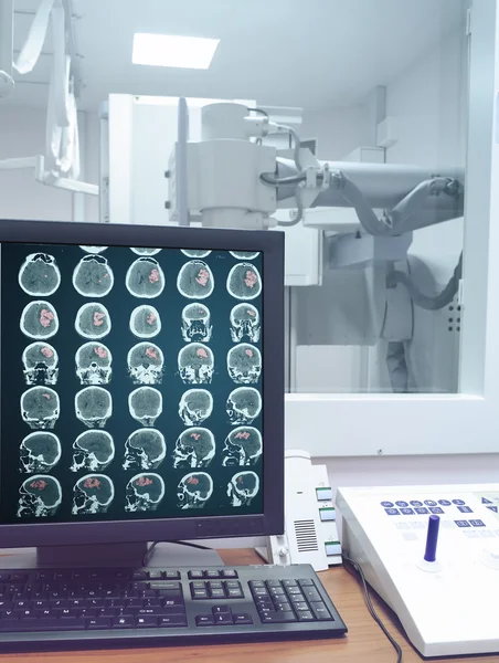 КТ-сканування на моніторі в рентгенівській лабораторії — стокове фото
