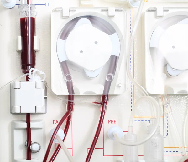 Machine d'hémodialyse au travail. Photo en gros plan . — Photo
