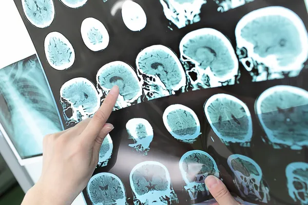Doktor görünümü ct taraması çıktı.