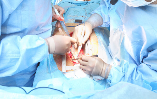 cardiac surgery. Open-heart surgery.