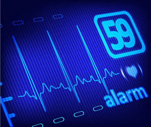 의료 모니터에 ecg 알람 — 스톡 사진