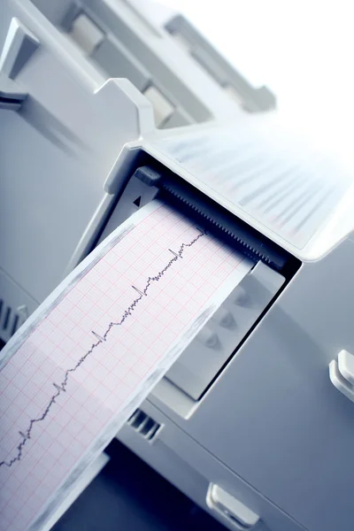 Cardiogram opname. — Stockfoto