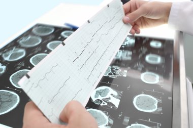 EKG ve tomografi çalışması