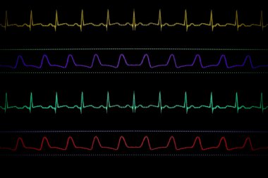 tıbbi monitör. dört eğrileri ile ekran