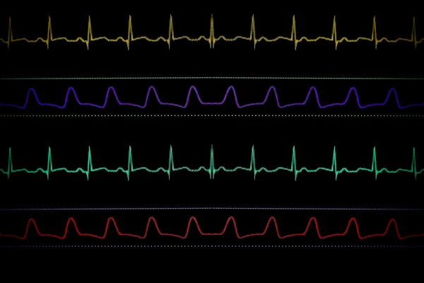 Monitor Médico. Tela com quatro curvas — Fotografia de Stock