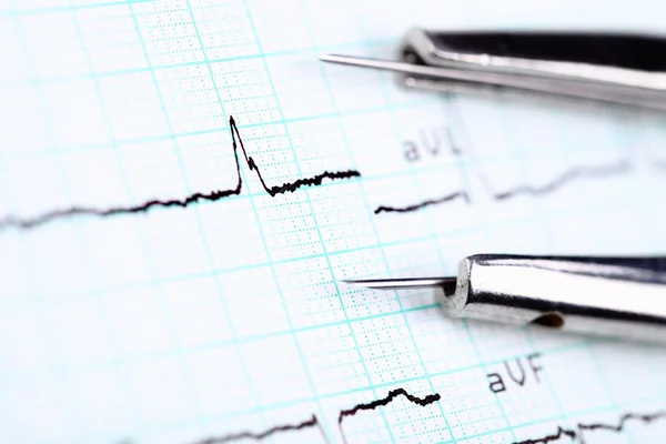 Elektrokardiogram och en kompass. elektrokardiogram för proffs — Stockfoto
