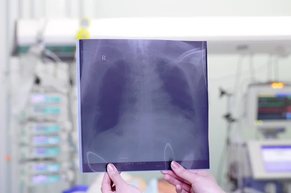 Bryst x-ray billede i ICU - Stock-foto