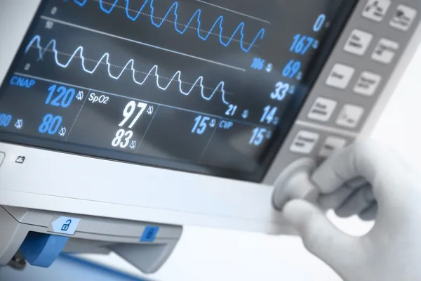 Medical electronics. Monitor with ECG curves — Stock Photo, Image