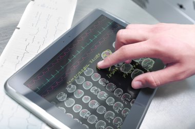 doktor hastane verileri ile dijital tablet üzerinde çalışır.
