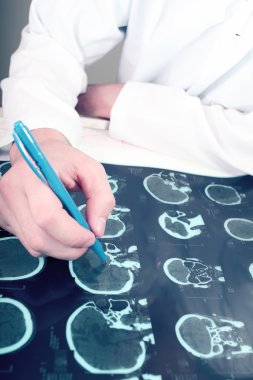 Doktor ve tomografi
