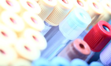 laboratuvar test tüpleri