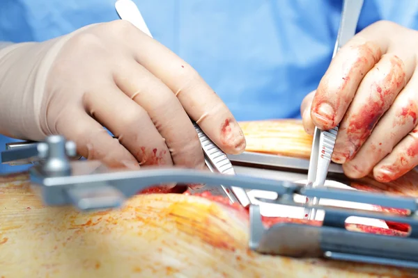 Chirurga ruce na ránu. chirurgie koncept — Stock fotografie