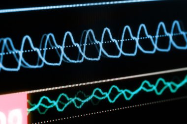 bilgisayar monitörü eğrileri. iş Özeti.