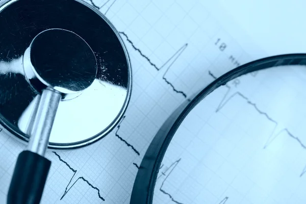 Study of cardiogram — 图库照片