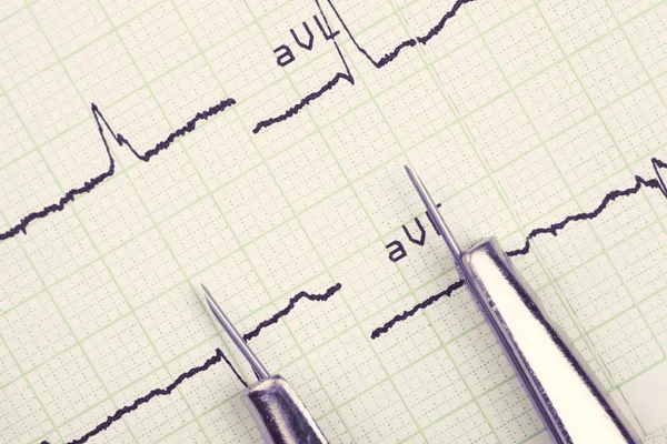 Instrumento y cardiograma. antecedentes médicos — Foto de Stock