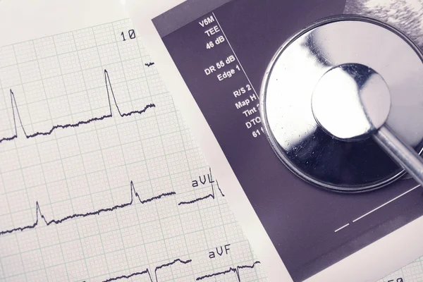 Stethoscope, ECG, echocardiography blank — Stock Photo, Image
