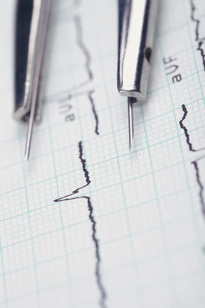 ECG analysis. Compasses on medical cardiogram — Stock Photo, Image