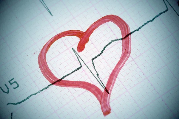 Tvar srdce na elektrokardiogramu. — Stock fotografie