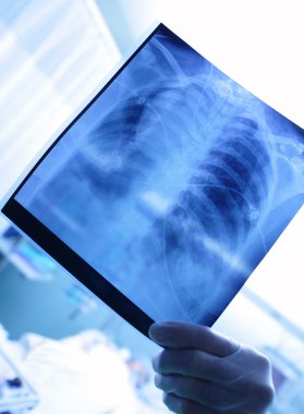 Doktor Röntgen veya hastanın röntgen görüntü savaşta holding