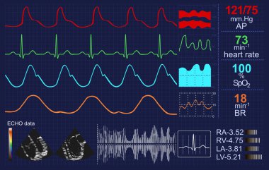 Kalp monitörü eğrileri ve diğer veriler
