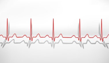 kalp atışı EKG. hacimsel kavramı