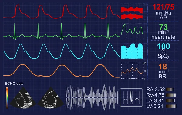 Heartbeat monitor med massor av kurvor och andra data — Stockfoto