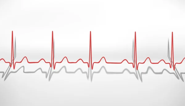 Szívverés EKG. térfogat fogalma — Stock Fotó