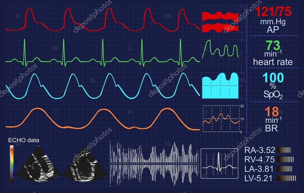 diefstal een beetje blad Heartbeat monitor with lots of curves and other data Stock Photo by ©sudok1  46777433