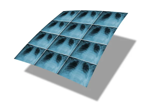 Conjunto de filmes de raios X distorcidos no espaço. Isolado em branco — Fotografia de Stock