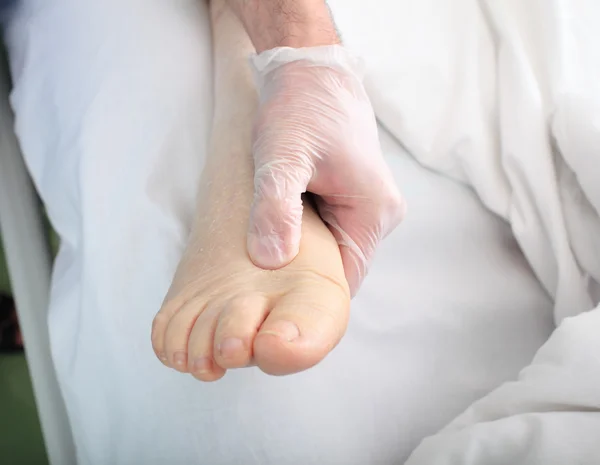 Läkaren undersöker foten av tunga patient med ödem — Stockfoto