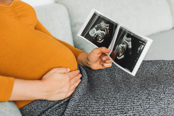 Беременная женщина смотрит на первое ультразвуковое фото своего ребенка, ласкает живот, счастливо ожидая рождения ребенка. Беременность первого триместра — стоковое фото