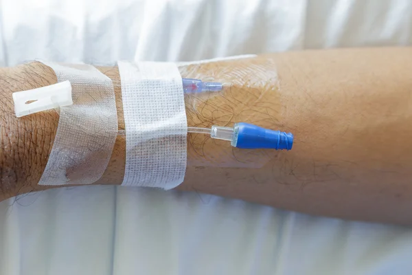 Agulha intravenosa no braço do doente para injeção de medicamento — Fotografia de Stock