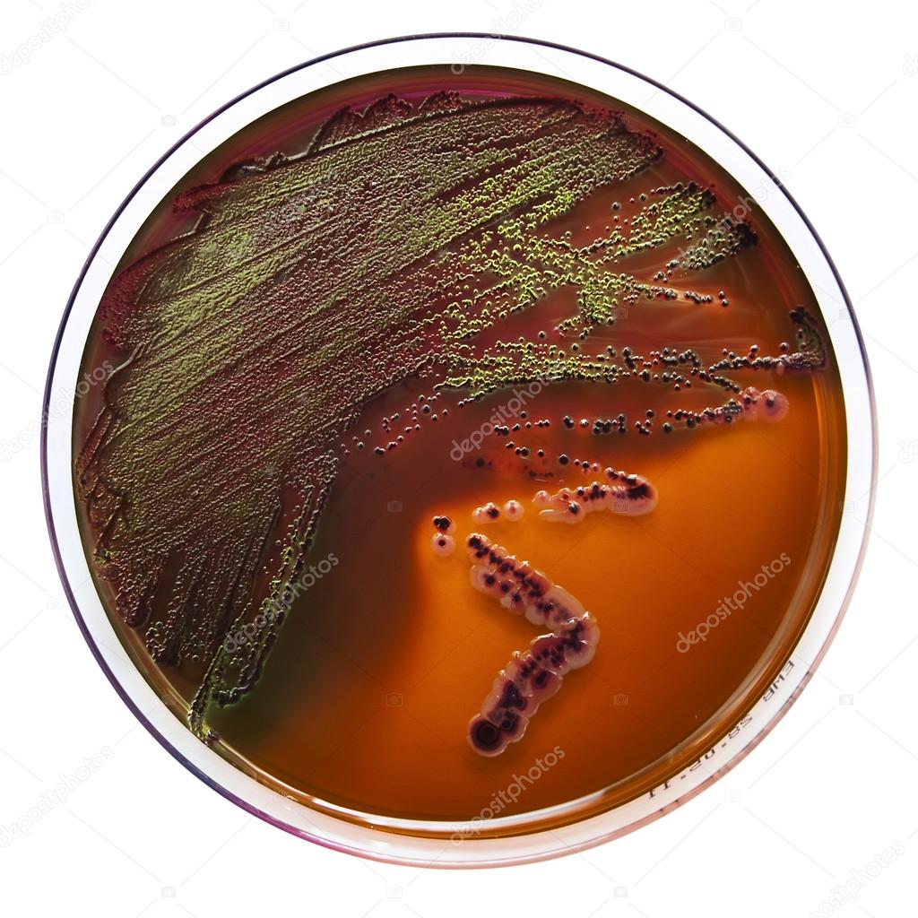 Petri dish with bacteria