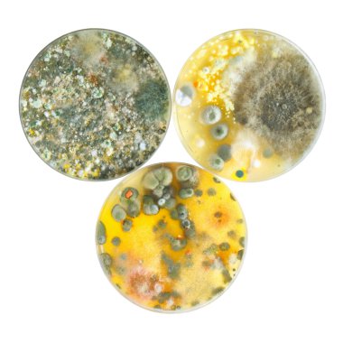 Petri dishes with mold clipart