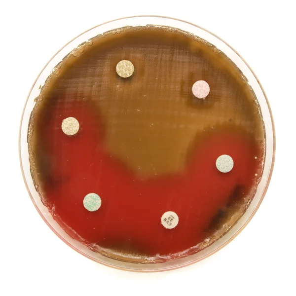 Ensayo de resistencia antimicrobiana de difusión de discos — Foto de Stock