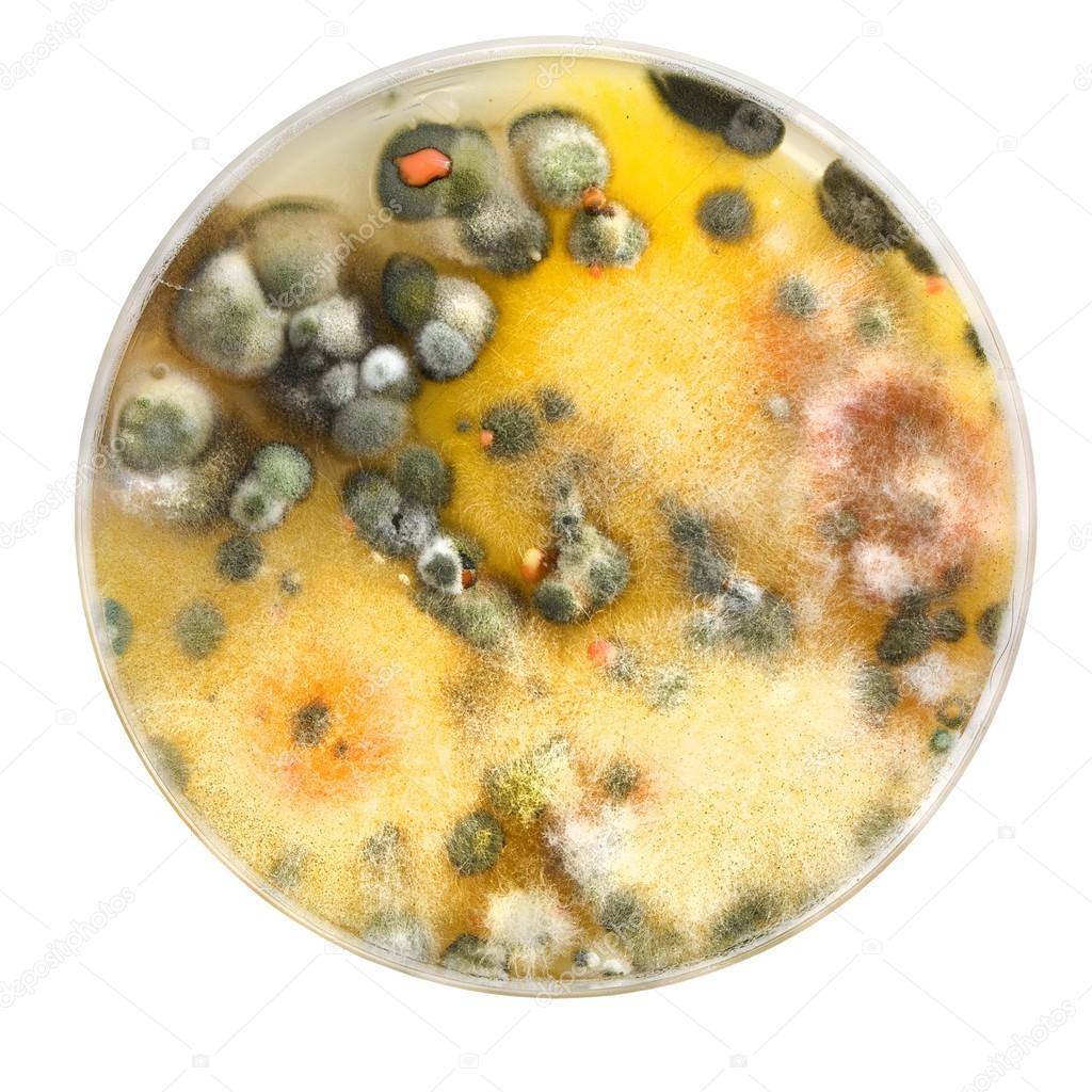 petri dish with mold