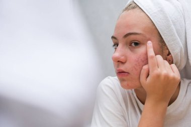A teenage girl in a white towel on her head is looking at her face with problem skin in the mirror clipart