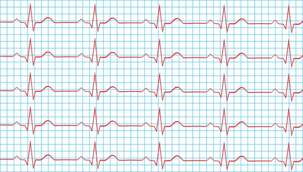 心電図 Vector Art Stock Images Depositphotos