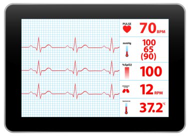 Modern Elektrokardiyogram monitör aygıtı görüntüleme