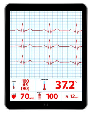 Modern Elektrokardiyogram monitör aygıtı görüntüleme