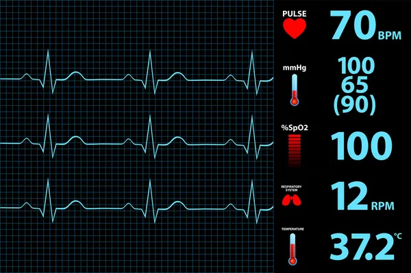 Affichage moderne de moniteur d'électrocardiogramme — Image vectorielle