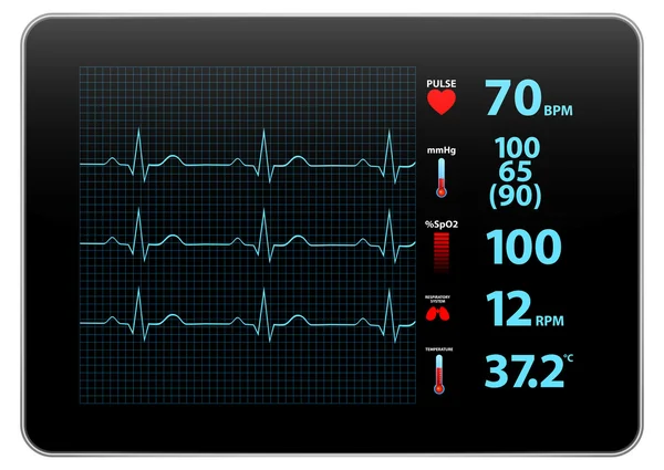 Moderne elektrocardiogram controleren apparaat weergeven — Stockvector