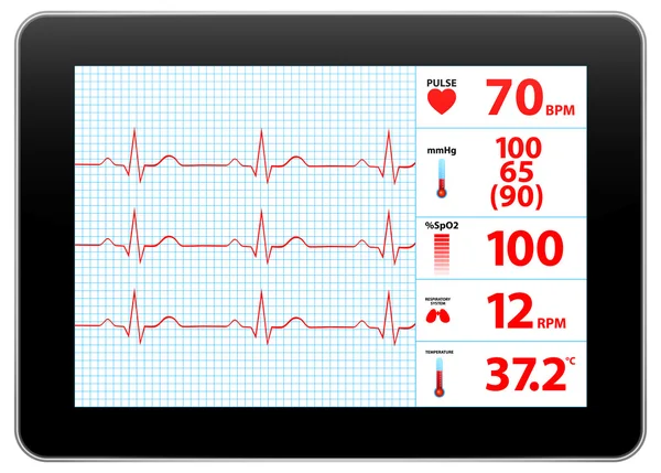 Modern Electrocardiogram Monitor Device Display — Stock Vector