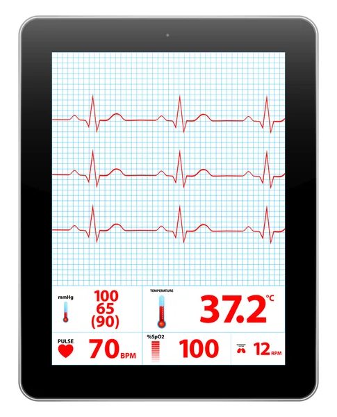 Exibição de dispositivo de monitor de eletrocardiograma moderno — Vetor de Stock