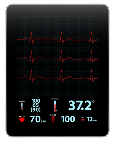 Modern Electrocardiogram Monitor Device Display — Stock Vector