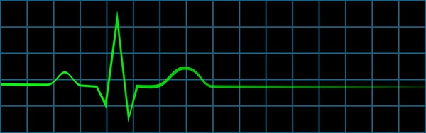 Electrocardiograma que muestra el último latido del corazón — Archivo Imágenes Vectoriales